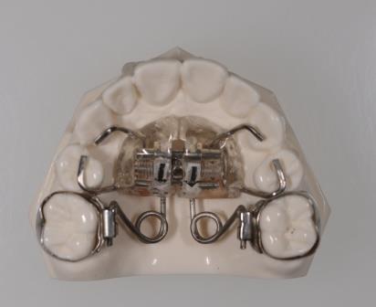 ペンデュラムの装置